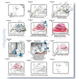 037V Storyboards for Nasonex Animation