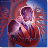 Atrial-Fibrillation-or-AFIB-Image-338