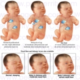 202V-Newborn-Assessments