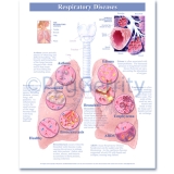 Respiratory Diseases Poster 494