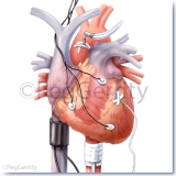 069 Cardiac Emergencies in Layers