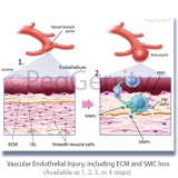 359V Aneurysm Vessel Inflammation