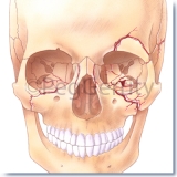 299-Head-Trauma-B