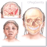 299-ML-Head-Trauma