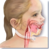 332ML-Ingested-Toxins-A