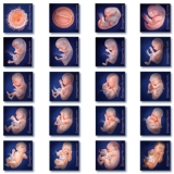 Fetal-Growth-for-State-Depts-Health-WRTK-Set-415