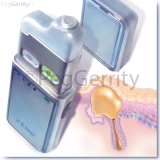 Device-Zeno-for-Acne-Image-488