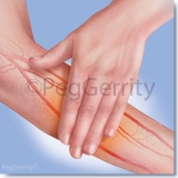 Diabetic-Arm-Rub-w-Arteries-Image-267